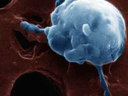 еволюційна історія пов'язана з раком клітин
