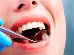 протезування зубів: знімні або незнімні протези?